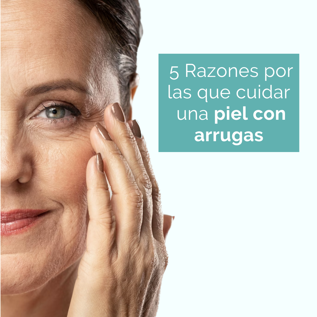 5 Razones por las que cuidar una piel con arrugas