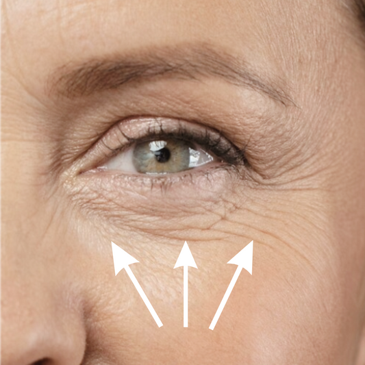 ¿Por qué deberíamos usar ya el Contorno de Ojos Antiedad Natural?